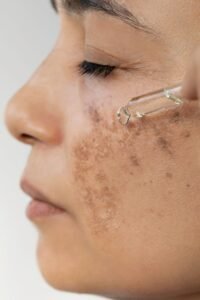 Hyde Hydroquinone