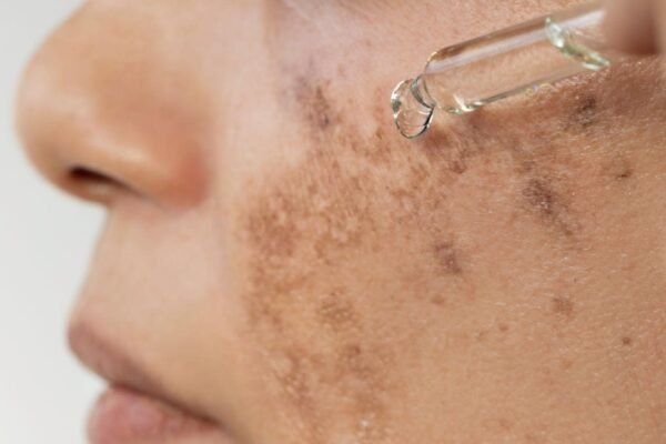 Hyde Hydroquinone